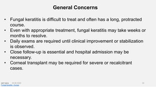 General Concerns
• Fungal keratitis is difficult to treat and often has a long, protracted
course.
• Even with appropriate treatment, fungal keratitis may take weeks or
months to resolve.
• Daily exams are required until clinical improvement or stabilization
is observed.
• Close follow-up is essential and hospital admission may be
necessary.
• Corneal transplant may be required for severe or recalcitrant
cases.
OCT 2014
Fungal Keratitis - Europe
26-06-2020 20
 