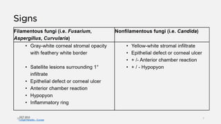 OCT 2014
Fungal Keratitis - Europe
26-06-2020 7
 