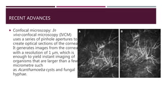 RECENT ADVANCES
 Confocal microscopy: In
vivo confocal microscopy (IVCM)
uses a series of pinhole apertures to
create optical sections of the cornea.
It generates images from the cornea
with a resolution of 1 μm, which is
enough to yield instant imaging of
organisms that are larger than a few
micrometre such
as Acanthamoeba cysts and fungal
hyphae.
 