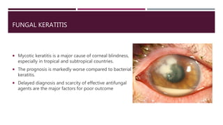 FUNGAL KERATITIS
 Mycotic keratitis is a major cause of corneal blindness,
especially in tropical and subtropical countries.
 The prognosis is markedly worse compared to bacterial
keratitis.
 Delayed diagnosis and scarcity of effective antifungal
agents are the major factors for poor outcome
 