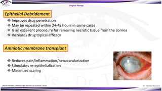 Dr. Tukezban Huseynova
Surgical Therapy
Epithelial Debridement
v Improves drug penetration
v May be repeated within 24-48 hours in some cases
v Is an excellent procedure for removing necrotic tissue from the cornea
v Increases drug topical efficacy
Amniotic membrane transplant
v Reduces pain/inflammation/neovascularization
v Stimulates re-epithelialization
v Minimizes scaring
„Mycotic Keratitis“, Mahendra Rai, Marcelo Luis Occhiutto (2019)
 