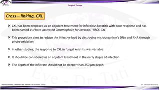 Dr. Tukezban Huseynova
Surgical Therapy
Cross – linking, CXL
v CXL has been proposed as an adjutant treatment for infectious keratitis with poor response and has
been named as Photo Activated Chromophore for keratitis: ‘PACK-CXL’
v This procedure aims to reduce the infective load by destroying microorganism's DNA and RNA through
photo-oxidation
v In other studies, the response to CXL in fungal keratitis was variable
v It should be considered as an adjutant treatment in the early stages of infection
v The depth of the infiltrate should not be deeper than 250 µm depth
„Mycotic Keratitis“, Mahendra Rai, Marcelo Luis Occhiutto (2019)
 