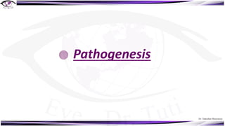 Dr. Tukezban Huseynova
Pathogenesis
 