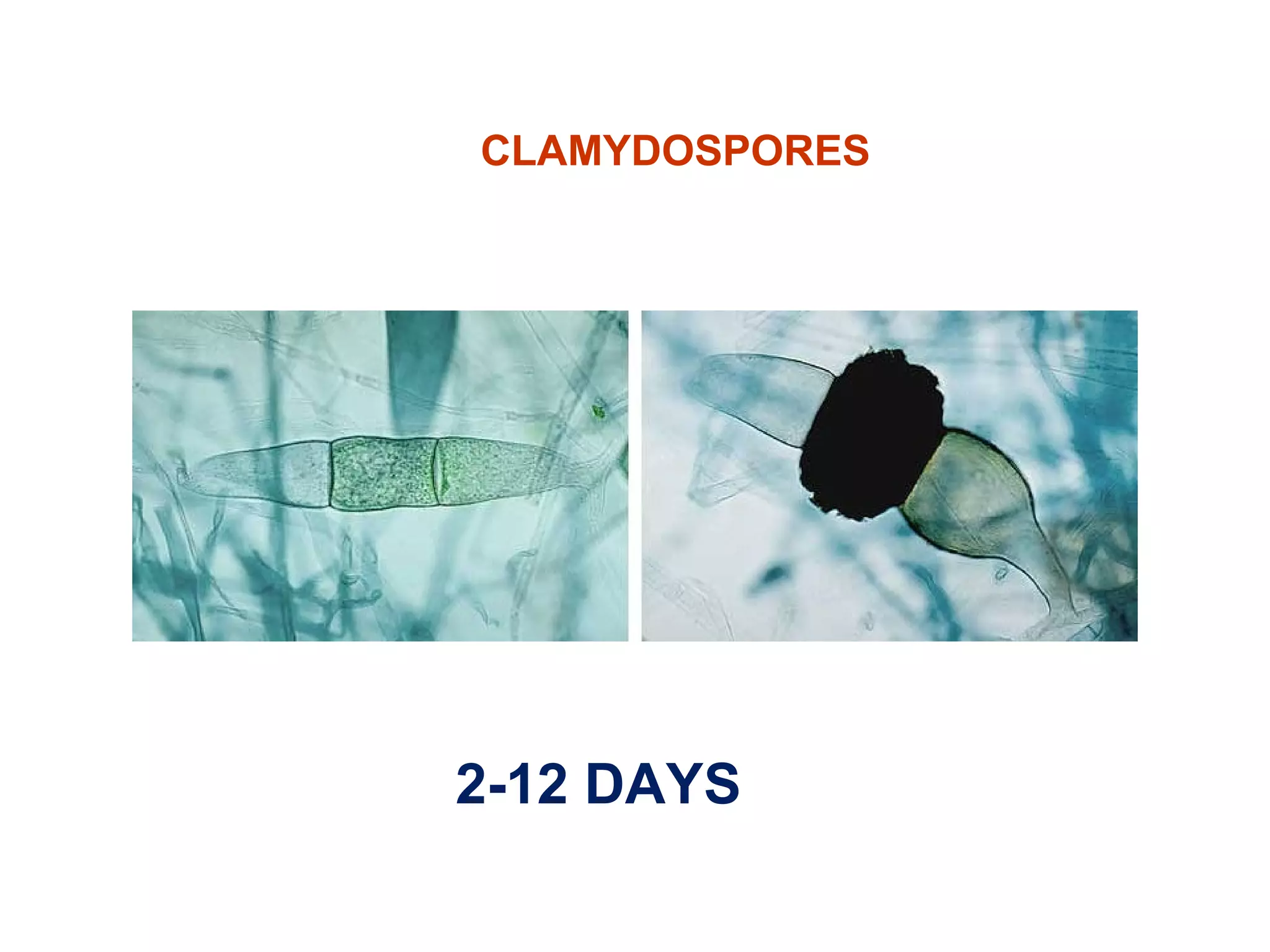 CLAMYDOSPORES 
2-12 DAYS 
 
