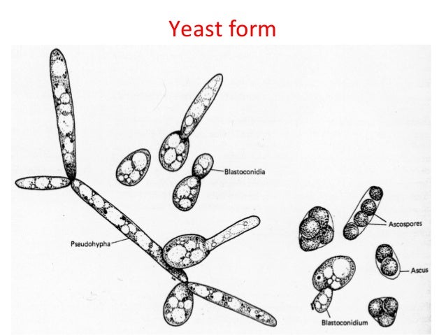 fungal presentation yeast form