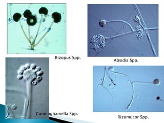 Absidia Spp.
Rizomucor Spp.
Rizopus Spp.
Cunninghamella Spp.
 
