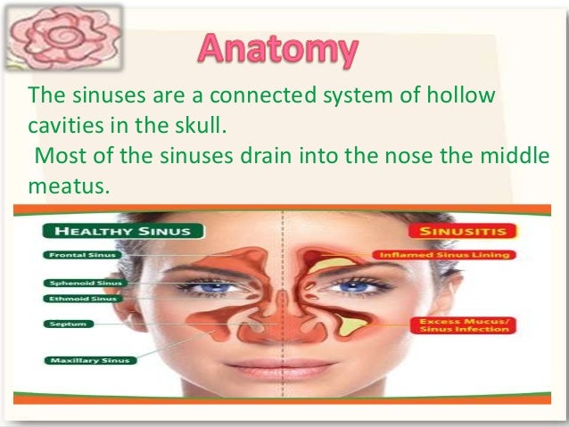 Fungal sinusitis