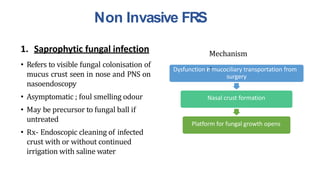 Non Invasive FRS
1. Saprophytic fungal infection
• Refers to visible fungal colonisation of
mucus crust seen in nose and PNS on
nasoendoscopy
• Asymptomatic ; foul smelling odour
• May be precursor to fungal ball if
untreated
• Rx- Endoscopic cleaning of infected
crust with or without continued
irrigation with saline water
Mechanism
Dysfunction in:mucociliary transportation from
surgery
Nasal crust formation
Platform for fungal growth opens
 