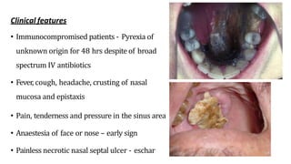 Clinical features
• Immunocompromised patients - Pyrexia of
unknown origin for 48 hrs despite of broad
spectrum IV antibiotics
• Fever, cough, headache, crusting of nasal
mucosa and epistaxis
• Pain, tenderness and pressure in the sinus area
• Anaestesia of face or nose – early sign
• Painless necrotic nasal septal ulcer - eschar
 