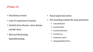 CT Scan- IOC
• Focal bony erosion
• Lack of expansion of sinuses
• Limited sinus disease- more disease
outside sinus
• Mucosal thickening:
hypoattenuating
• Nasal septal ulceration
• Fat stranding outside the sinus perimeter
 intraorbital fat
 periantral fat
 nasolacrimal duct
 lacrimal sac
 masticator space
 pterygopalatinefossa
 
