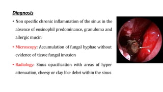 Diagnosis
• Non specific chronic inflammation of the sinus in the
absence of eosinophil predominance, granuloma and
allergic mucin
• Microscopy: Accumulation of fungal hyphae without
evidence of tissue fungal invasion
• Radiology: Sinus opacification with areas of hyper
attenuation, cheesy or clay like debri within the sinus
 