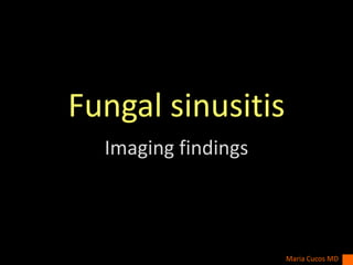 Fungal sinusitis
Imaging findings
Maria Cucos MD
 