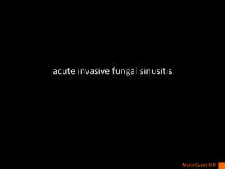 acute invasive fungal sinusitis
Maria Cucos MD
 