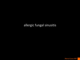 allergic fungal sinusitis
Maria Cucos MD
 