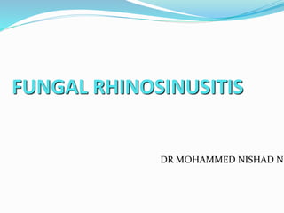 FUNGAL RHINOSINUSITIS
DR MOHAMMED NISHAD N
 