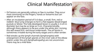 1.Fungal skin infections slideshare.pptx
