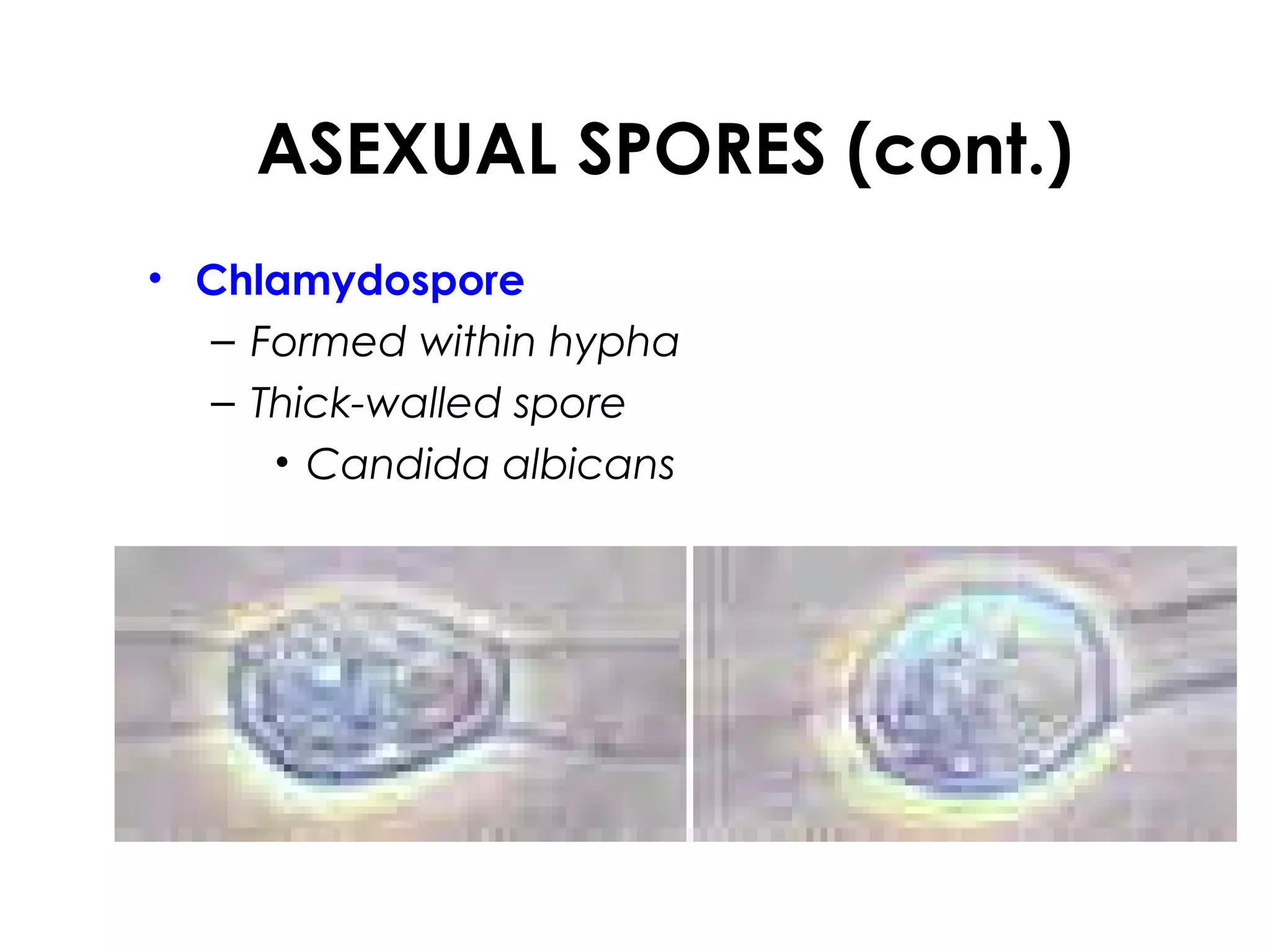 ASEXUAL SPORES (cont.)
• Chlamydospore
– Formed within hypha
– Thick-walled spore
• Candida albicans
 