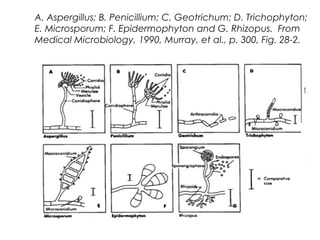 A. Aspergillus; B. Penicillium; C. Geotrichum; D. Trichophyton;
E. Microsporum; F. Epidermophyton and G. Rhizopus.  From
Medical Microbiology, 1990, Murray, et al., p. 300, Fig. 28-2.
 