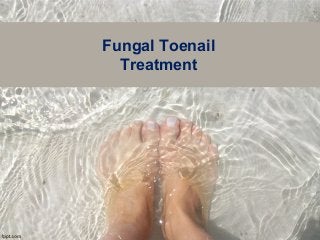 Fungal Toenail
Treatment
 