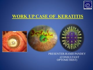 WORK UP CASE OF KERATITIS
PRESENTER-RAMJI PANDEY
(CONSULTANT
OPTOMETRIST)
 