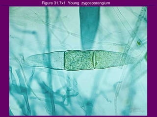 Figure 31.7x1  Young  zygosporangium 