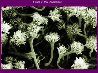 Figure 31.9x2  Aspergillus 