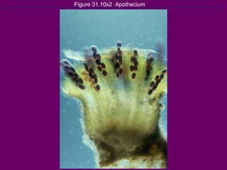 Figure 31.10x2  Apothecium 