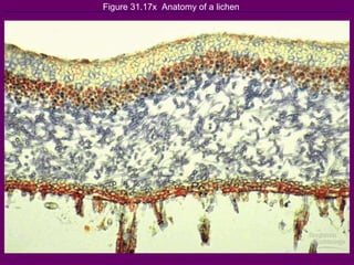 Figure 31.17x  Anatomy of a lichen 