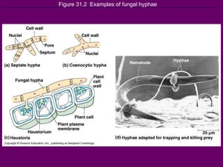 Figure 31.2  Examples of fungal hyphae 