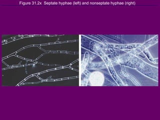 Figure 31.2x  Septate hyphae (left) and nonseptate hyphae (right) 