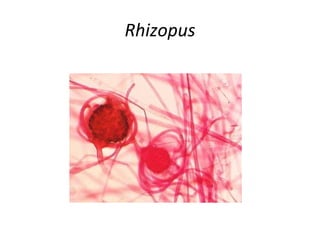 Rhizopus 