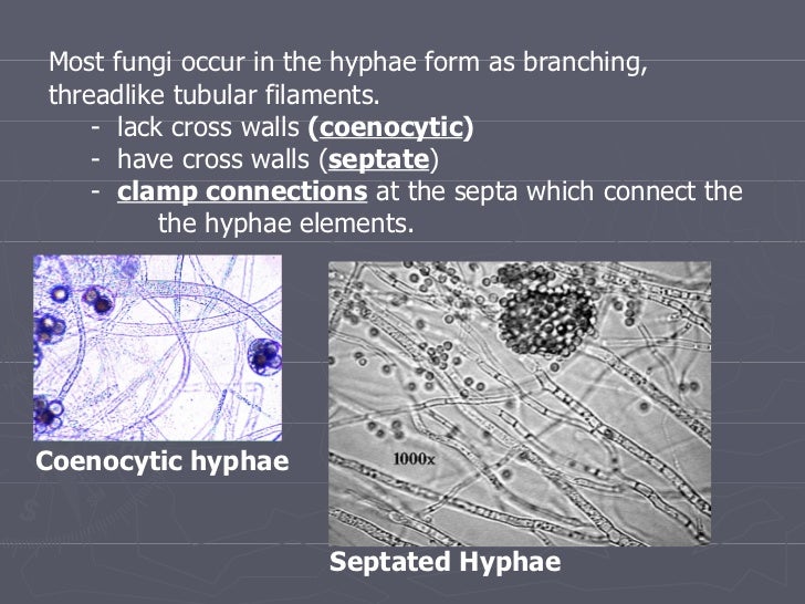 Fungi 11951828376485593