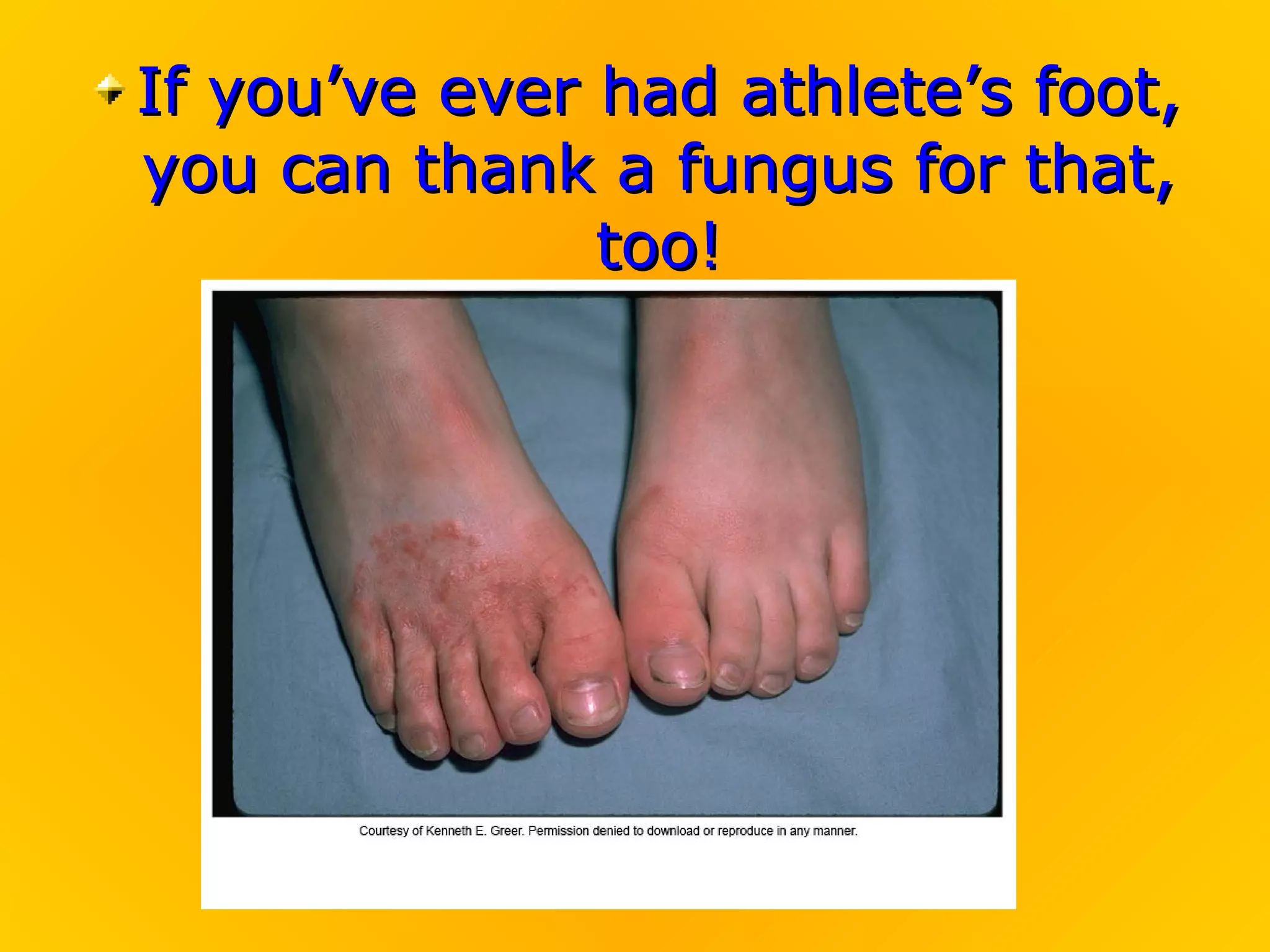 If you’ve ever had athlete’s foot,
you can thank a fungus for that,
               too!
 