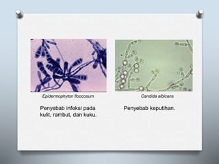 Epidermophyton floocosum Candida albicans
Penyebab infeksi pada
kulit, rambut, dan kuku.
Penyebab keputihan.
 