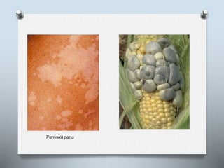 Penyakit panu
 