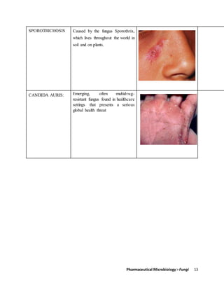 Pharmaceutical Microbiology> Fungi 13
SPOROTRICHOSIS Caused by the fungus Sporothrix,
which lives throughout the world in
soil and on plants.
CANDIDA AURIS: Emerging, often multidrug-
resistant fungus found in healthcare
settings that presents a serious
global health threat
 