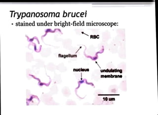 Trypanosoma brucei
stained under bright-field microscope:
flagellum
nucleus
RBC
undulating
membrane
10 um
 