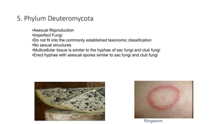 5. Phylum Deuteromycota
Ringworm
•Asexual Reproduction
•Imperfect Fungi
•Do not fit into the commonly established taxonomic classification
•No sexual structures
•Multicellular tissue is similar to the hyphae of sac fungi and club fungi
•Erect hyphae with asexual spores similar to sac fungi and club fungi
 