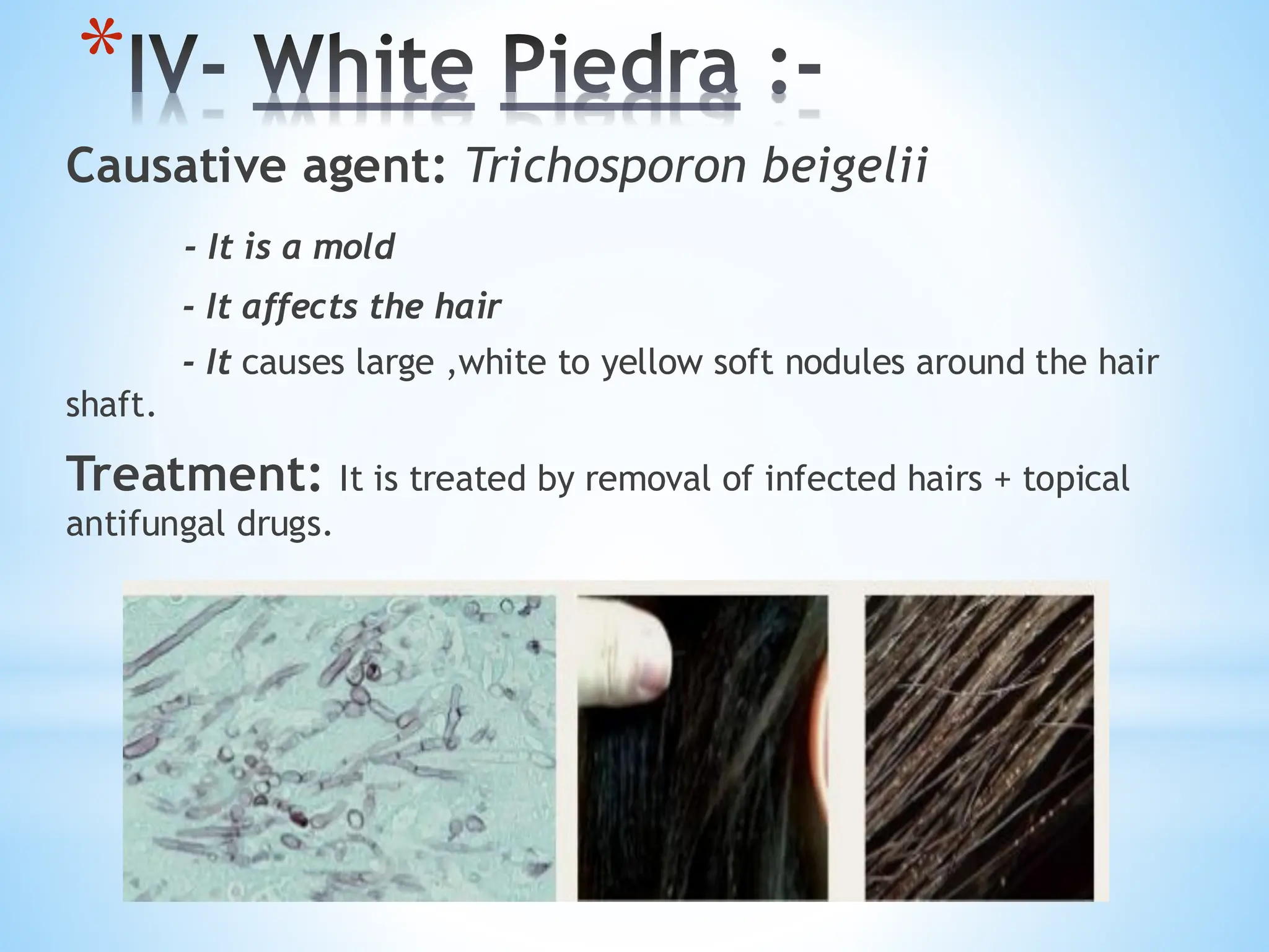 *IV- White Piedra :-
Causative agent: Trichosporon beigelii
- It is a mold
- It affects the hair
- It causes large ,white to yellow soft nodules around the hair
shaft.
Treatment: It is treated by removal of infected hairs + topical
antifungal drugs.
 
