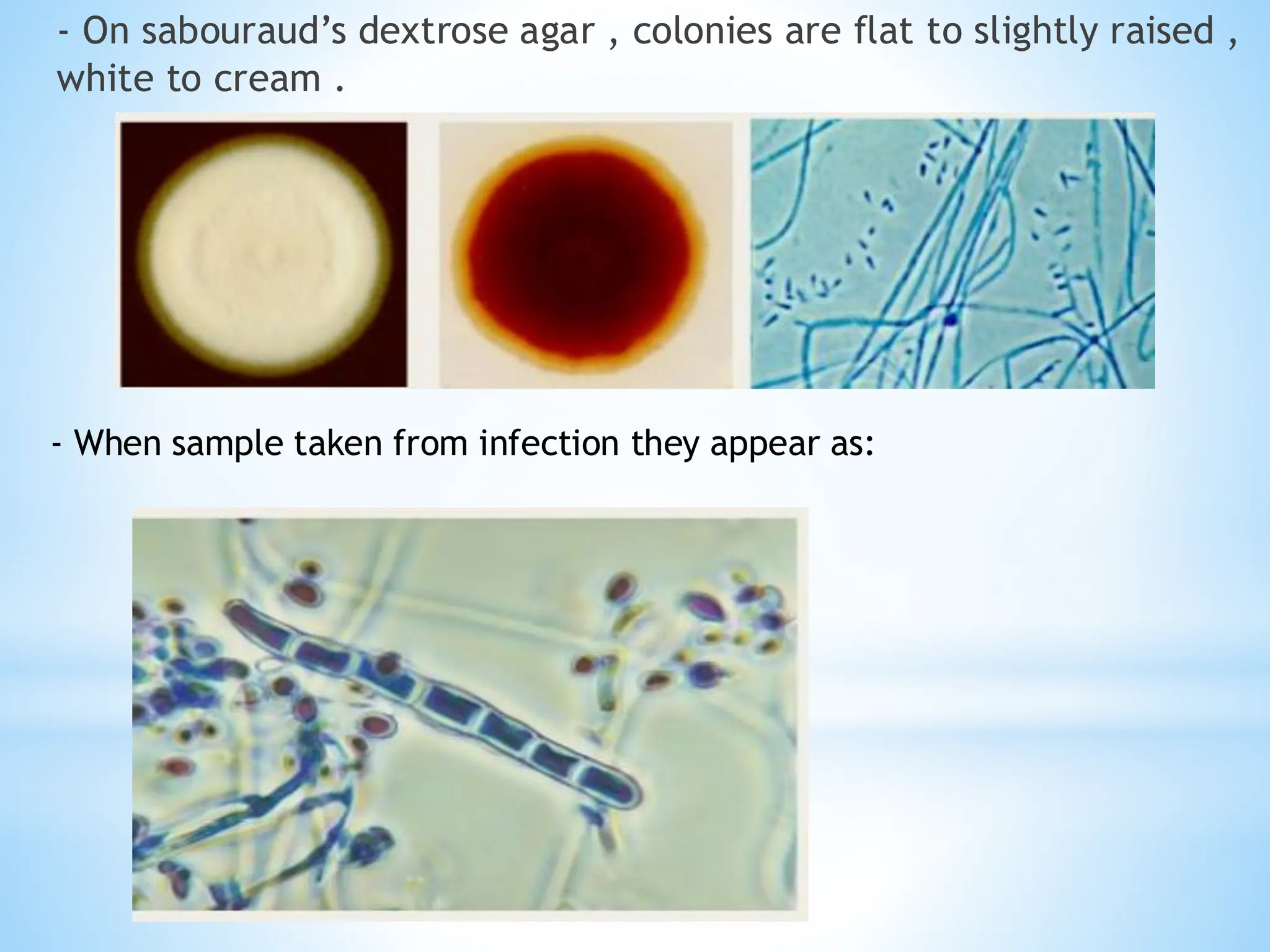 - On sabouraud’s dextrose agar , colonies are flat to slightly raised ,
white to cream .
- When sample taken from infection they appear as:
 