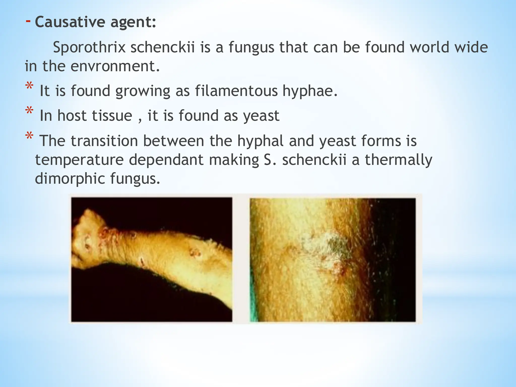 -Causative agent:
Sporothrix schenckii is a fungus that can be found world wide
in the envronment.
* It is found growing as filamentous hyphae.
* In host tissue , it is found as yeast
* The transition between the hyphal and yeast forms is
temperature dependant making S. schenckii a thermally
dimorphic fungus.
 