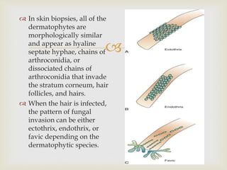 Fungi and antifungial therapy.pptx