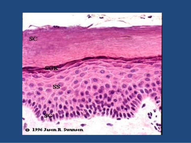 Fungi in tissue sectio...