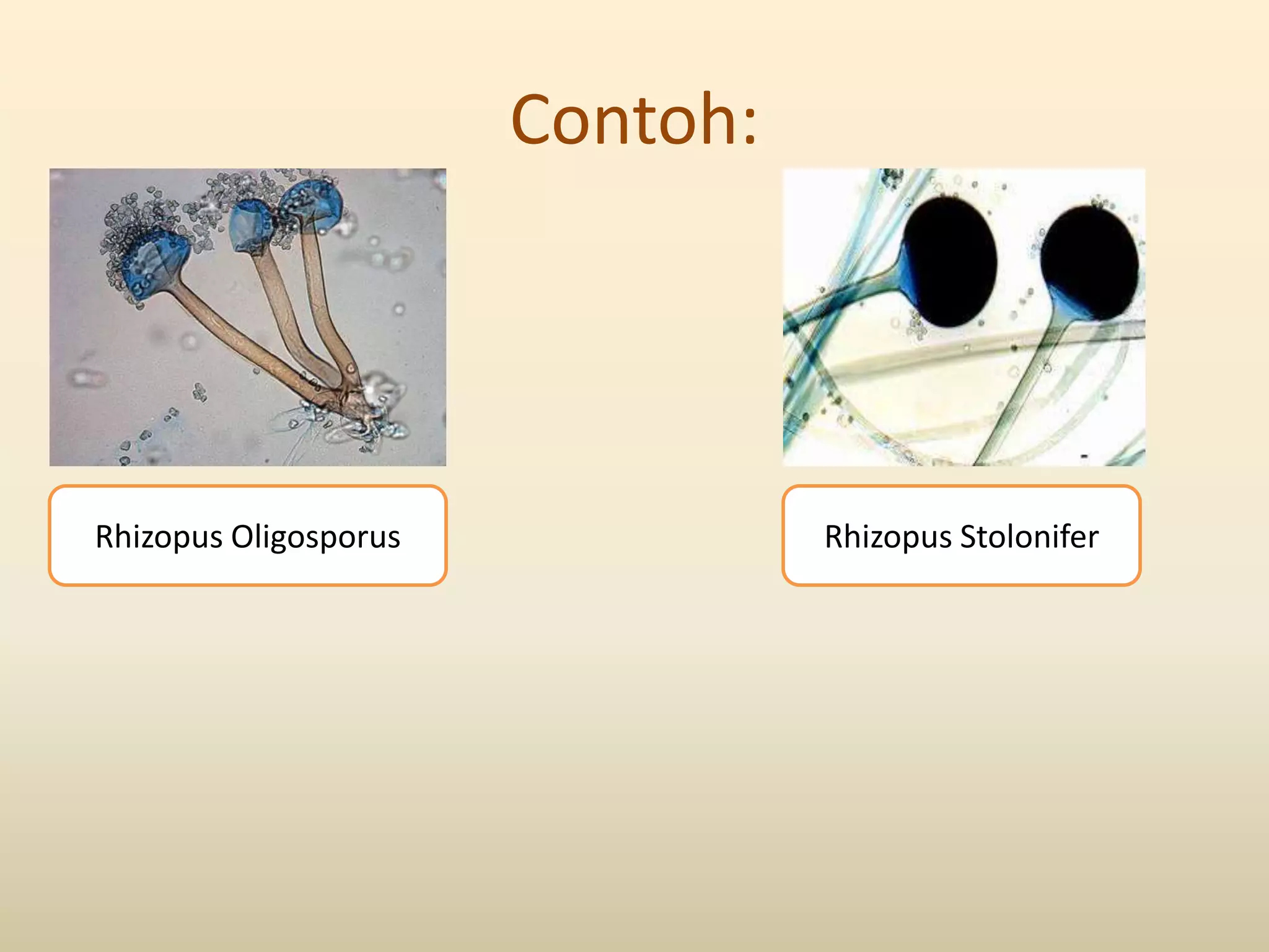 Contoh:




Rhizopus Oligosporus             Rhizopus Stolonifer
 