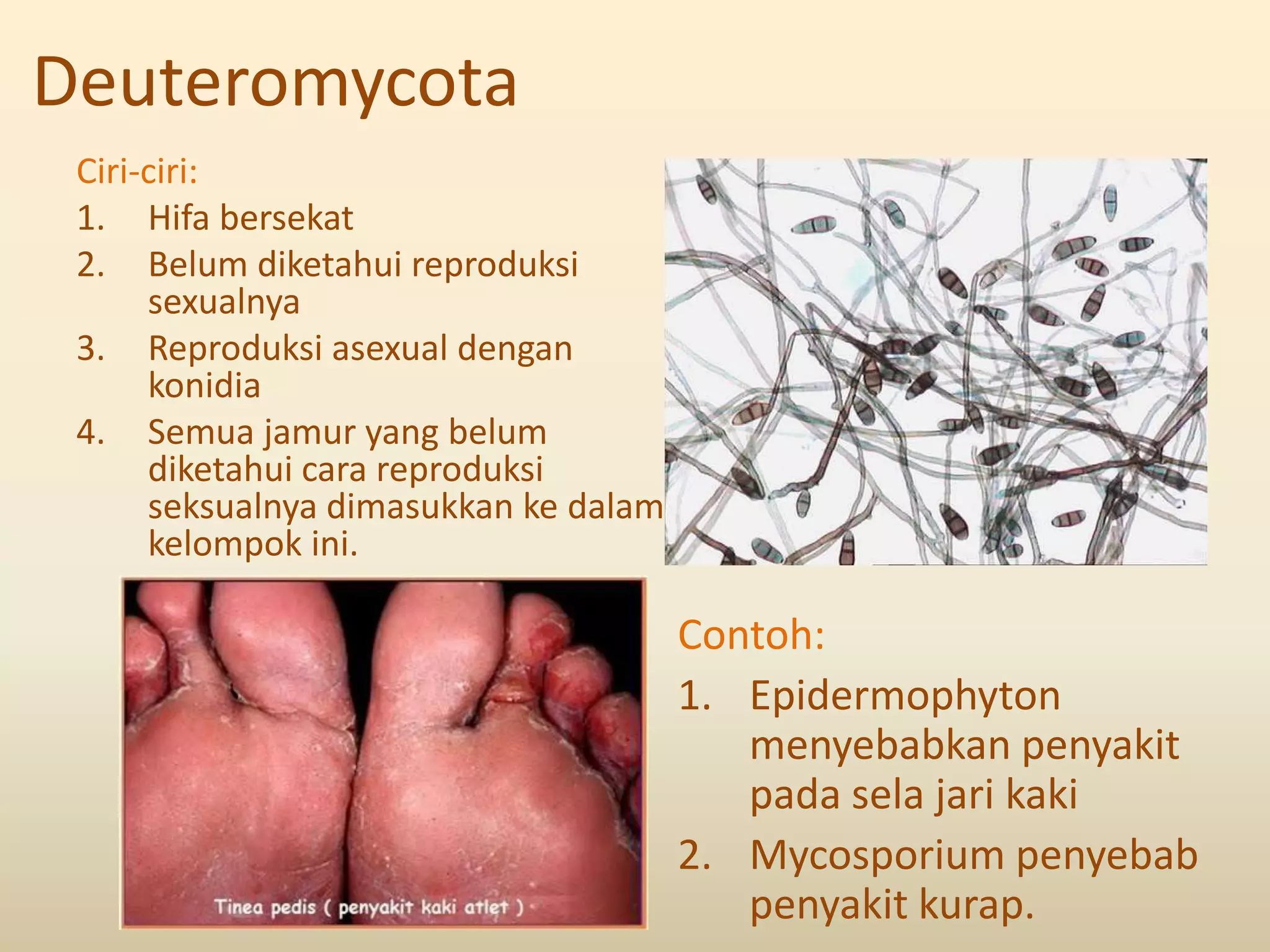 Deuteromycota
 Ciri-ciri:
 1. Hifa bersekat
 2. Belum diketahui reproduksi
      sexualnya
 3. Reproduksi asexual dengan
      konidia
 4. Semua jamur yang belum
      diketahui cara reproduksi
      seksualnya dimasukkan ke dalam
      kelompok ini.

                                       Contoh:
                                       1. Epidermophyton
                                          menyebabkan penyakit
                                          pada sela jari kaki
                                       2. Mycosporium penyebab
                                          penyakit kurap.
 