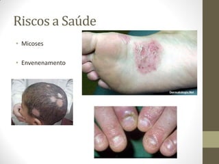Riscos a Saúde
• Micoses

• Envenenamento
 