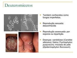 Deuteromicetos Também conhecidos como fungos imperfeitos. Reprodução sexuada: desconhecida Reprodução assexuada: por esporos ou bipartição. Doenças: candidíase ( Candida albicans ); frieira ( Trychophyton purpureum ); micoses de pele ( Epidermophyton floccosum ). 