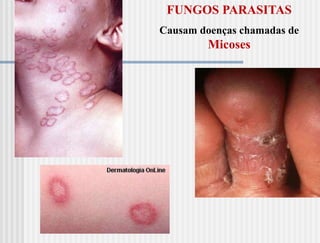 FUNGOS PARASITAS
Causam doenças chamadas de
         Micoses
 