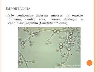 IMPORTÂNCIA
 São conhecidas diversas micoses na espécie
humana, dentre elas, merece destaque a
candidiase, sapinho (Candida albicans);
 