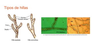 Tipos de hifas
 